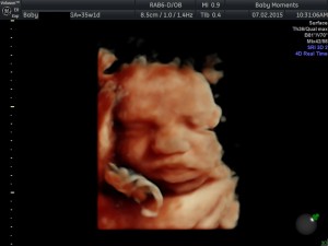 35 WKS 4d Pregnancy scan 
